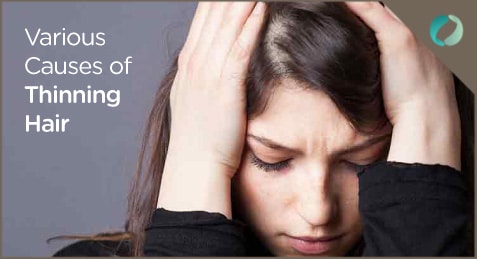 Various Causes of Thinning Hair