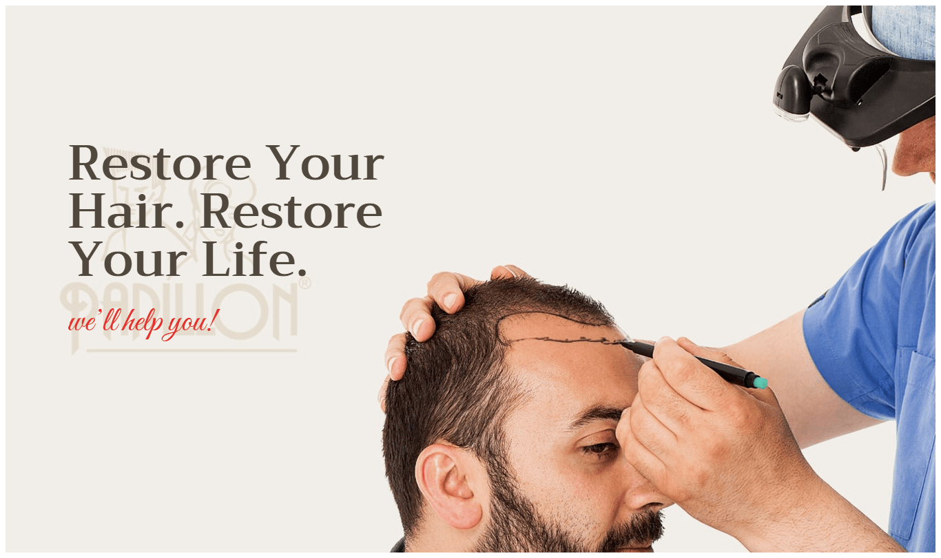 fue hair transplant